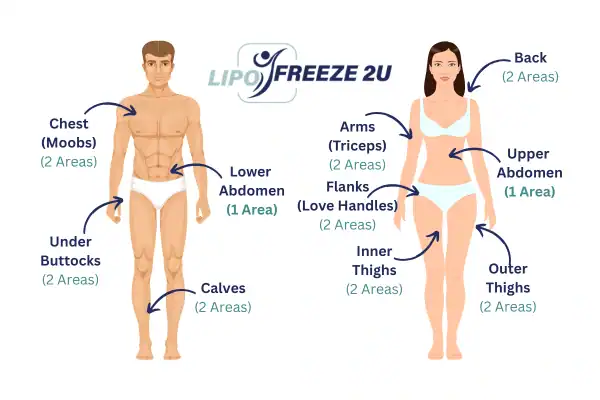 Areas you can have fat freezing treatment Wiltshire