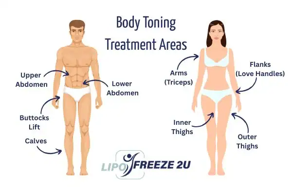 Graphic showing where you can have Body toning Treatment Wiltshire on your body
