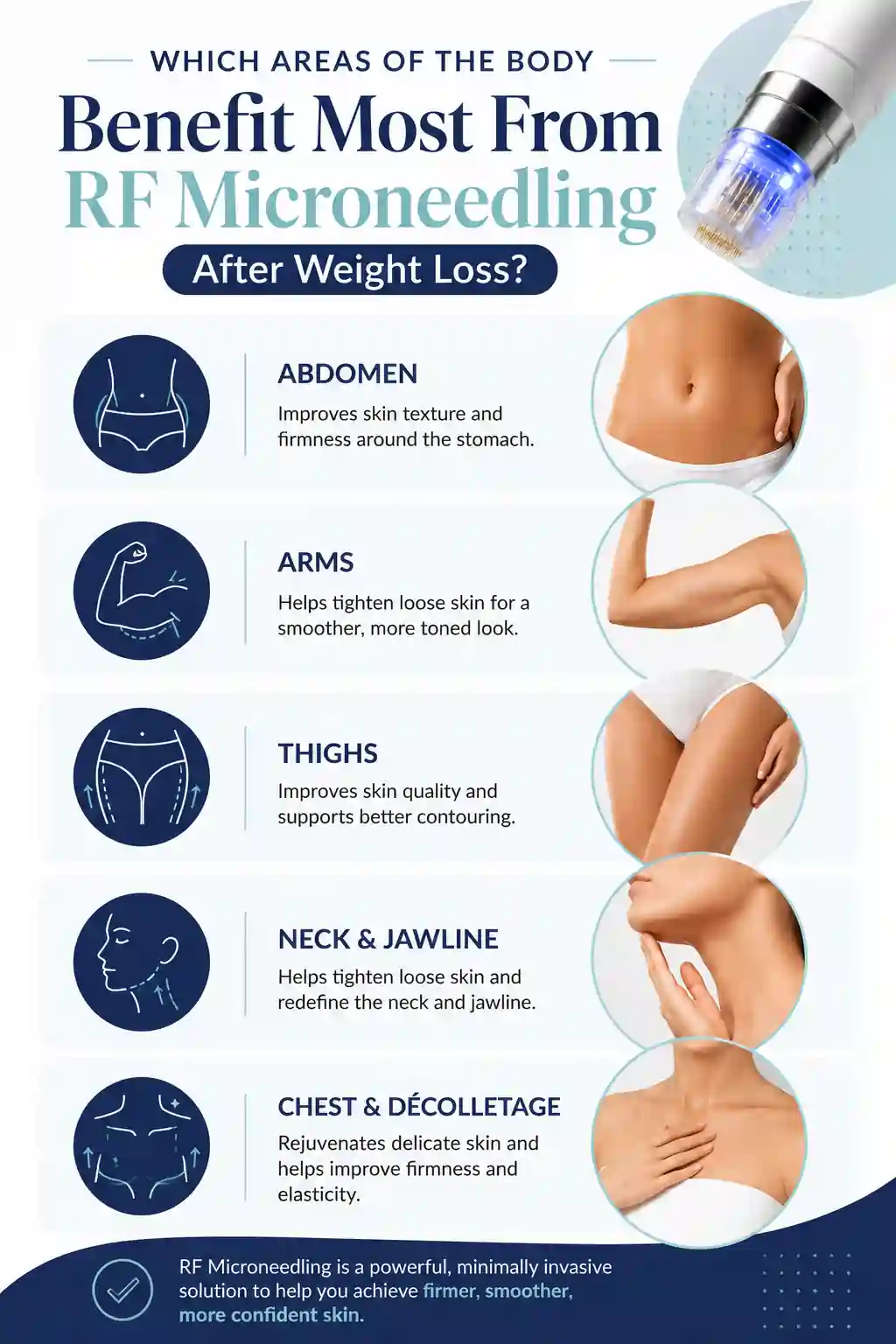 Which Areas of the Body Benefit Most From RF Microneedling After Weight Loss Wiltshire